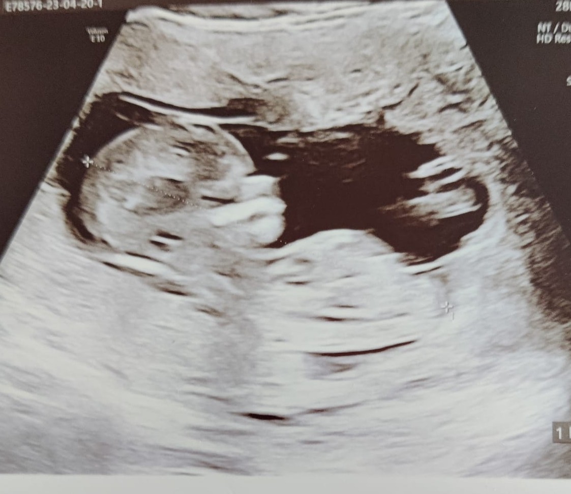 Alguien se viene...🔜🔜🔜🔜