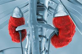 Nephrol00976063's tweet photo. Raising awareness about Chronic Kidney Disease is crucial, as millions of patients suffer from this condition globally..........
#CKDawareness #KidneyHealth
Read more: https://t.co/XEHrx44pmV https://t.co/YvGaUXAeqV