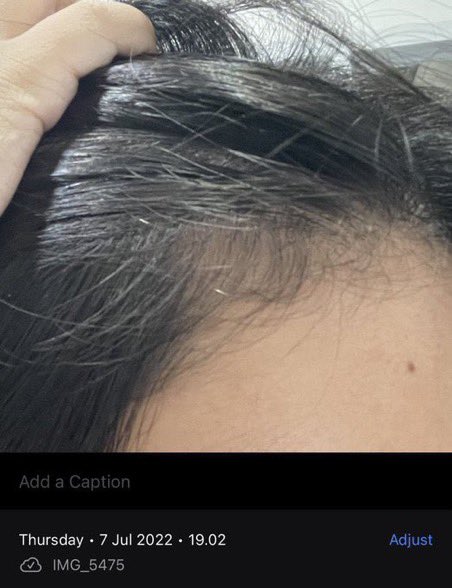 thisisforyaww's tweet photo. sampoo rambut rontok!

— a thread

from this                               to this https://t.co/7oLBCaojiT