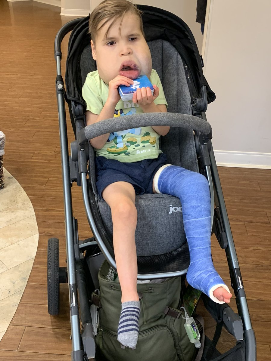 MUCoachJoe's tweet photo. All casted up… 4 weeks and we are free! https://t.co/Ohw1TKvUFt