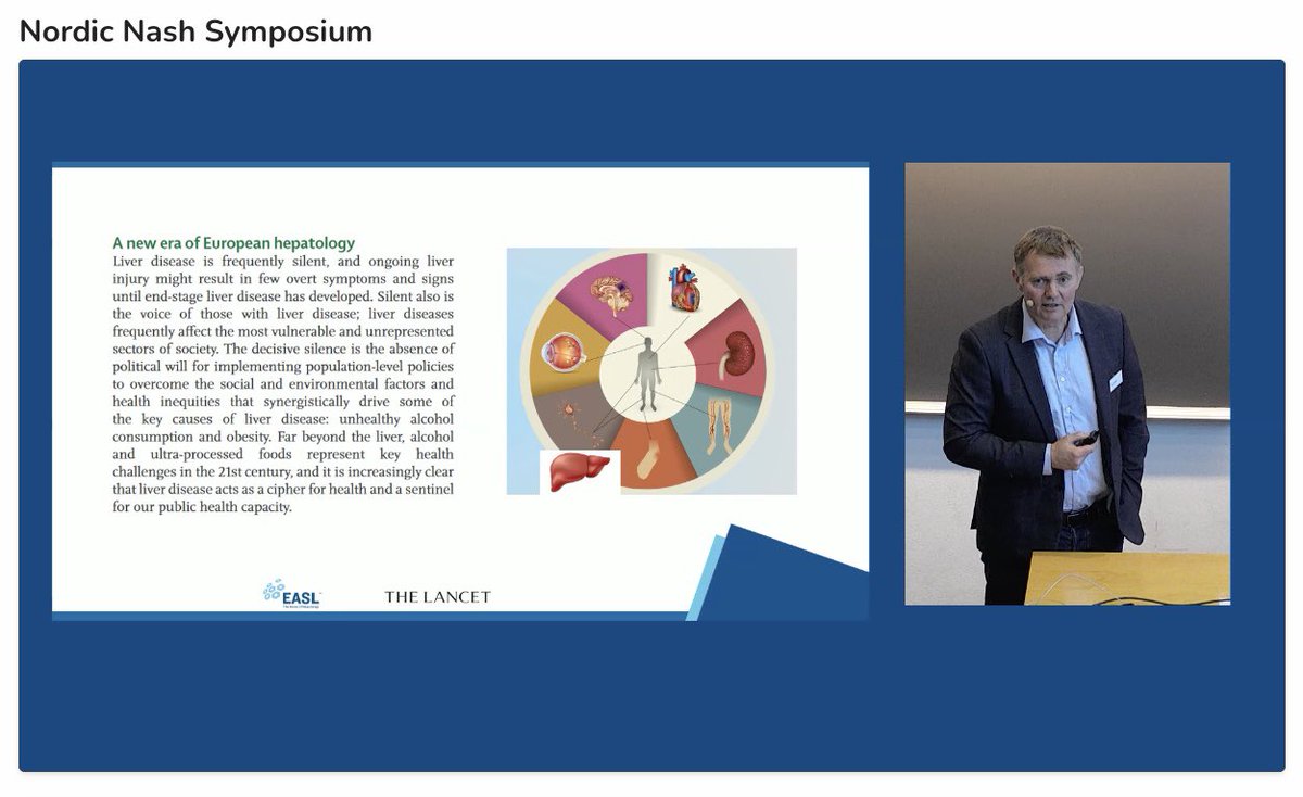 FattyLiverA's tweet photo. "The liver has an image problem".
Dr. @AleksanderKrag, Tom Karlsen from the Lancet and @marurinella at today’s Nordic NASH Symposium. Dr. Rinella reviews the history of NASH, the evolution of NAFLD nomenclature.

"We cannot marginalize patients”.
“We chose to use a Delphi process.”
“264 nominees were chosen.”
“Each round had about 1000 comments.”
“The role of alcohol altered disease.”
“Metabolic was difficult to define.”
“Perceived to be stigmatizing: 61% non-alcoholic and 66% fatty”.
