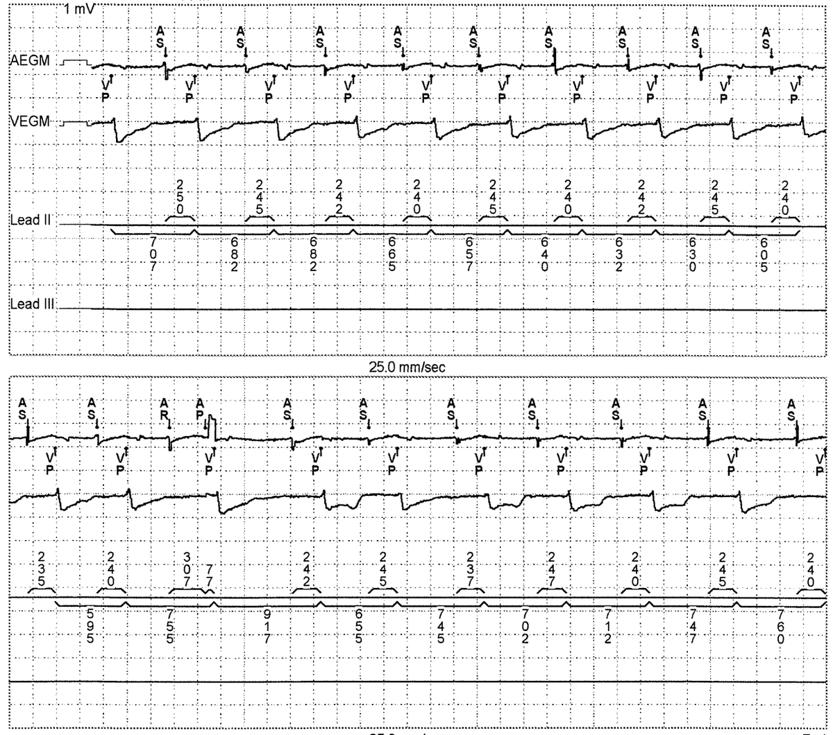 Jeffrey M Vinocur tweet media