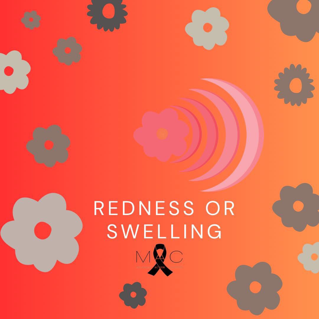 MelanomaAction's tweet image. If you notice redness or swelling outside the borders of an existing mole - get it checked