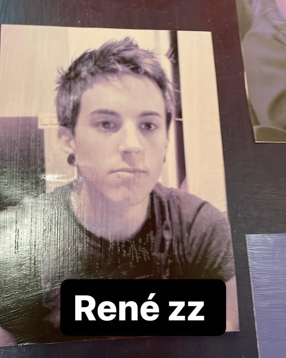 Renezzbro's tweet photo. Antes de probar la aguja VS después https://t.co/AdwnJVWmKU