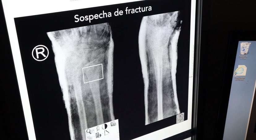 gustavoposse's tweet photo. ¡Una noticia que nos llena de orgullo!
A partir de esta semana, nuestros 3 hospitales municipales estarán implementando la #InteligenciaArtificial en el diagnóstico por imágenes.

Esta innovación nos permitirá brindar mayor precisión en los tratamientos y optimizar la atención. https://t.co/AG6IPEgjTv