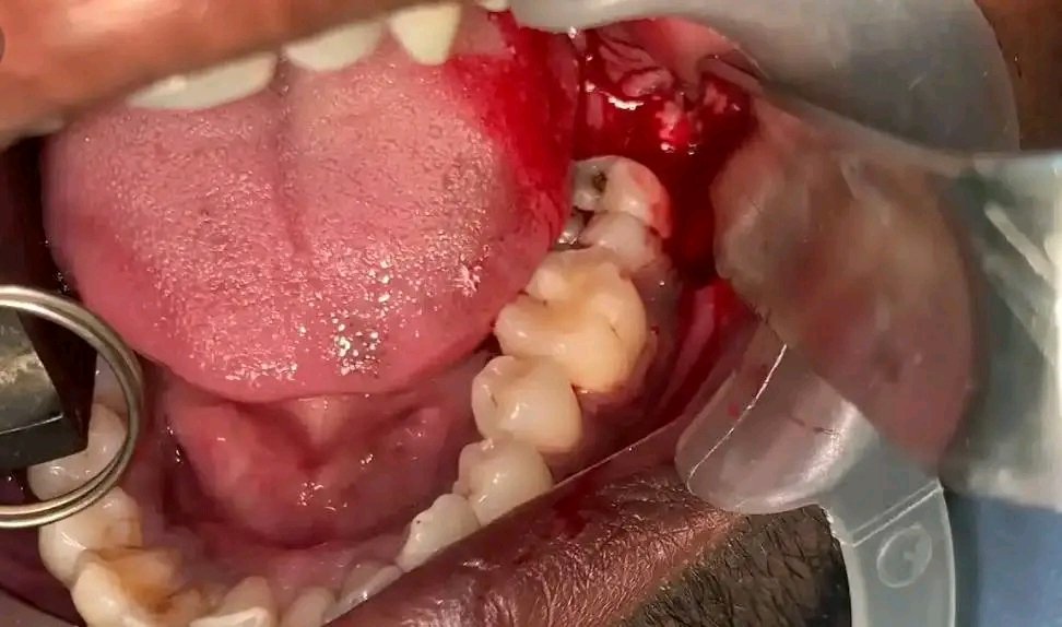 jackinto433442's tweet photo. @miraboi pls Boss I need your help to sort out my dental problem, this is really giving me issue for some months now I will be greatful for any amount
and help you can render to me , I have drop account several times but nothing has drop for me.
7034881654
Okay
Jack adunye https://t.co/FsxgaFenL9