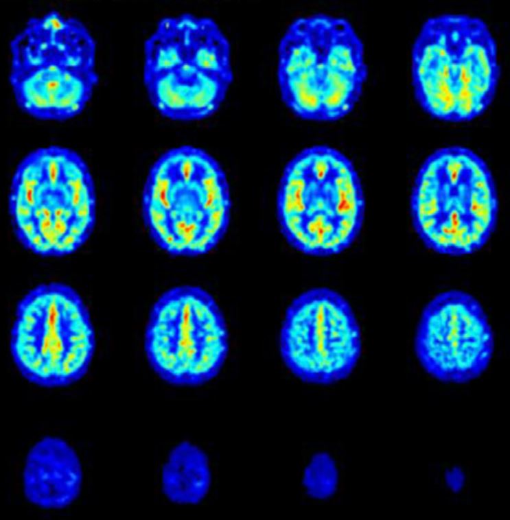 theMOINCC's tweet photo. 📢 7th Kiel Imaging Seminar #KIS at @kieluni will be on Monday, 24 April at 18:00 CET (12:00 EDT)! Prof. @matthiasvanosch from @UniLeiden presents on #ultrahighfield #MRI of the human brain clearance system #glymphatics.
For more details join us in Zoom! https://t.co/YRNBARAofF https://t.co/OGBtQjAmzt