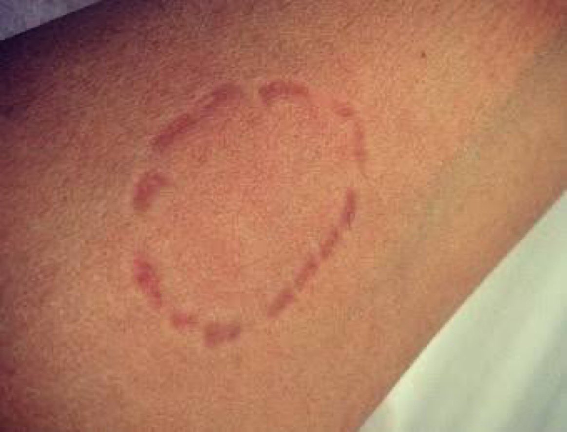 Comment tu montre de l’affection ?

: