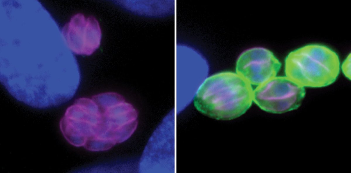 Whitehead Institute (@whiteheadinst) on Twitter photo The parasite toxoplasma gondii usually shifts from an initial, acute infection, to a chronic infection in their human hosts. New work from <a href="/LouridoLab/">Sebastian Lourido</a> uncovers a hierarchy of genes responsible for this transformation: wi.mit.edu/news/positive-… The parasite toxoplasma gondii usually shifts from an initial, acute infection, to a chronic infection in their human hosts. New work from <a href="/LouridoLab/">Sebastian Lourido</a> uncovers a hierarchy of genes responsible for this transformation: wi.mit.edu/news/positive-…