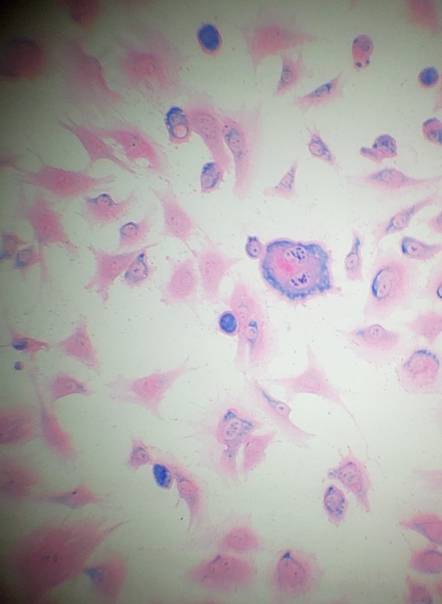 Rklick14's tweet photo. Great lab results this week!! Students in MI viewed cancer cells and performed a DNA Microarray to determine which genes should be studied further. @PLTWorg @ShakopeeSchools @SHS_HealthSci @SHSAcademies @edvotek https://t.co/yWBES0ysSH