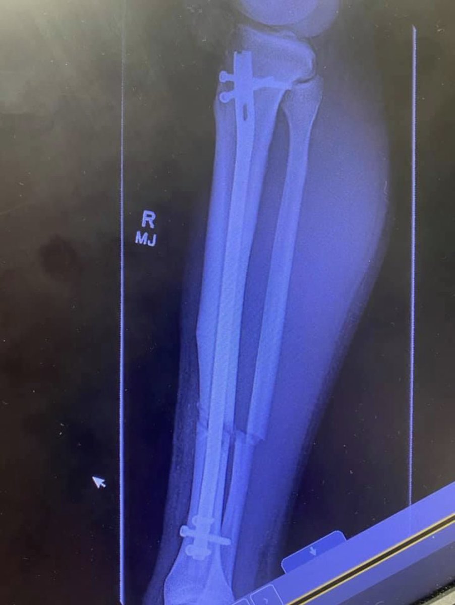 Creighton Mitchell tweet media