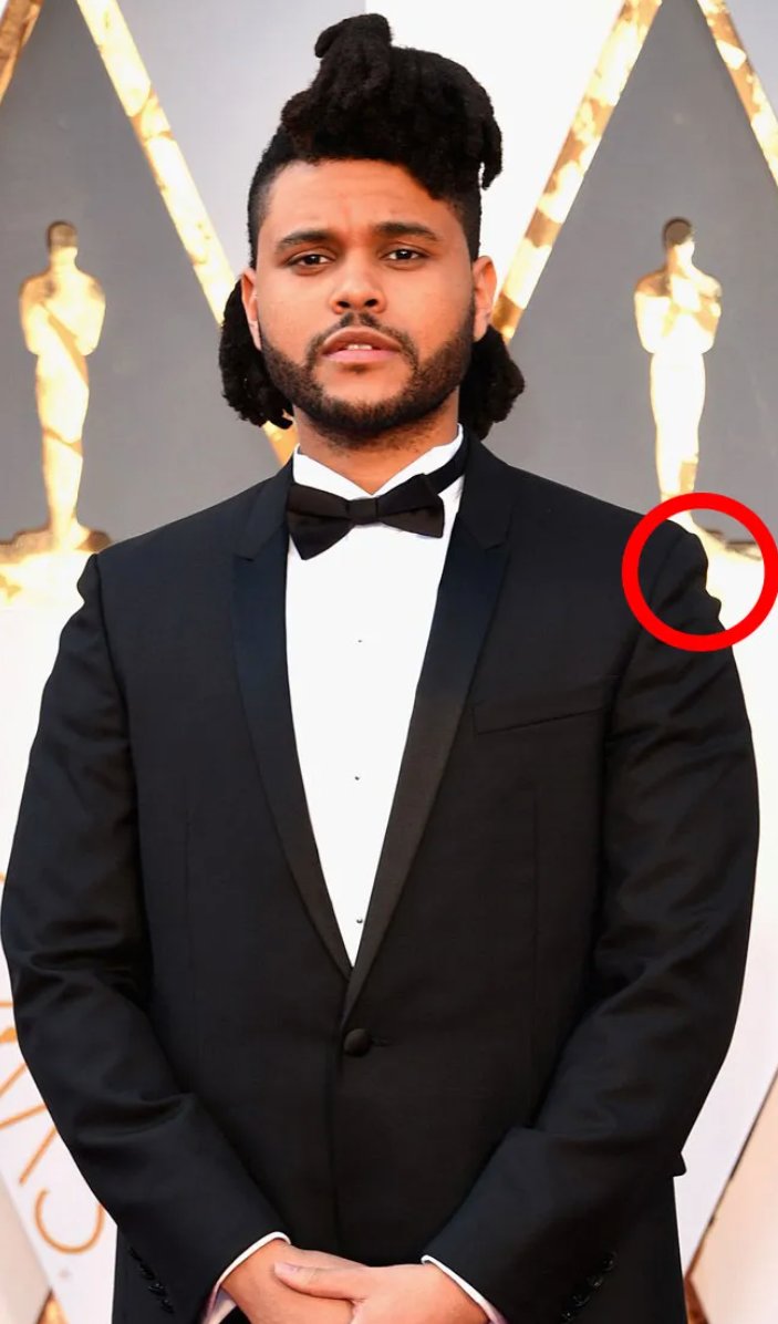 derek guy on Twitter "2. Shoulder Divots Another common issue is shoulder divots, which is when