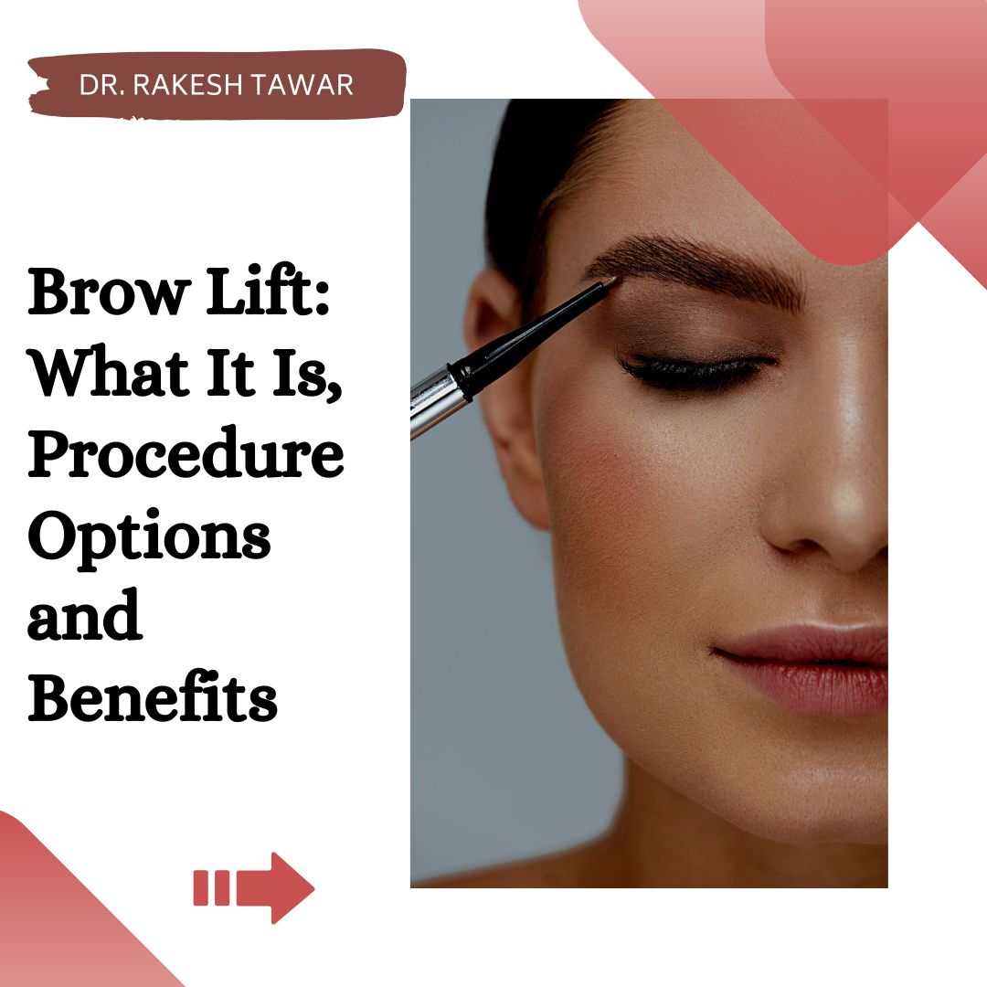 DrRakeshTawar1's tweet image. Get ready for a stunning transformation with a brow lift! 
Say goodbye to sagging eyebrows and hello to a more youthful and refreshed appearance. 
Book your consultation today and discover the incredible benefits of this procedure. 
#BrowLift #RefreshedLook #NaturalBeauty
