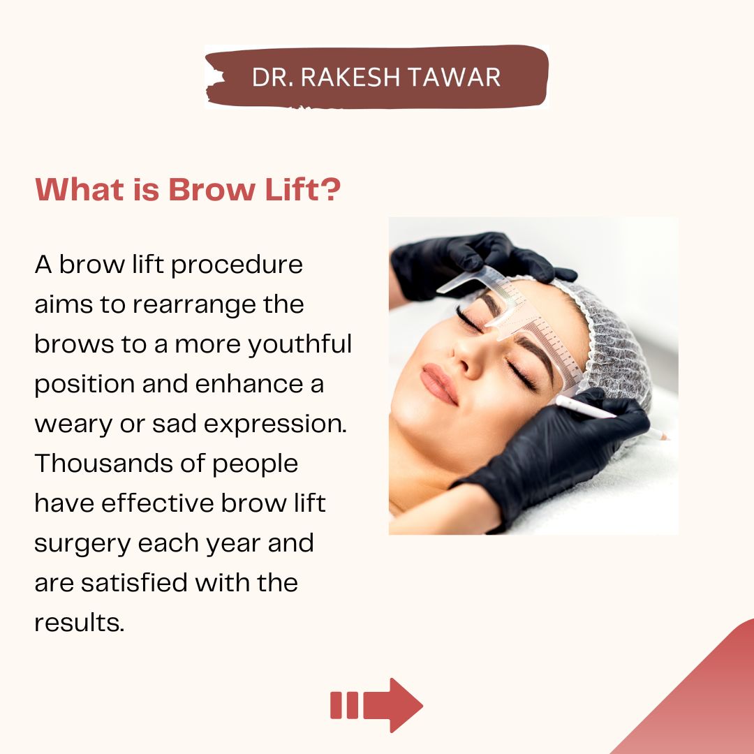 DrRakeshTawar1's tweet image. Get ready for a stunning transformation with a brow lift! 
Say goodbye to sagging eyebrows and hello to a more youthful and refreshed appearance. 
Book your consultation today and discover the incredible benefits of this procedure. 
#BrowLift #RefreshedLook #NaturalBeauty