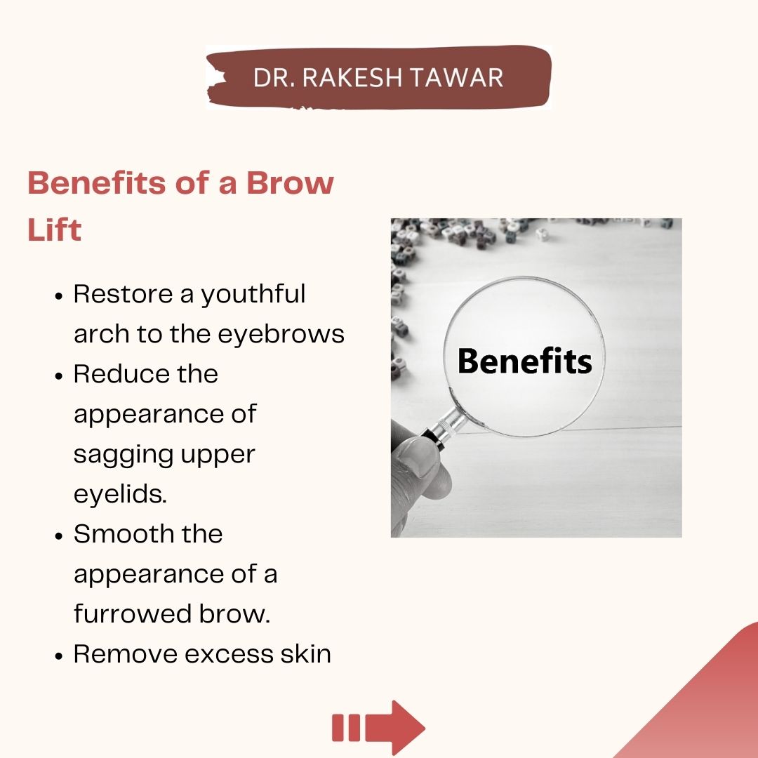 DrRakeshTawar1's tweet image. Get ready for a stunning transformation with a brow lift! 
Say goodbye to sagging eyebrows and hello to a more youthful and refreshed appearance. 
Book your consultation today and discover the incredible benefits of this procedure. 
#BrowLift #RefreshedLook #NaturalBeauty