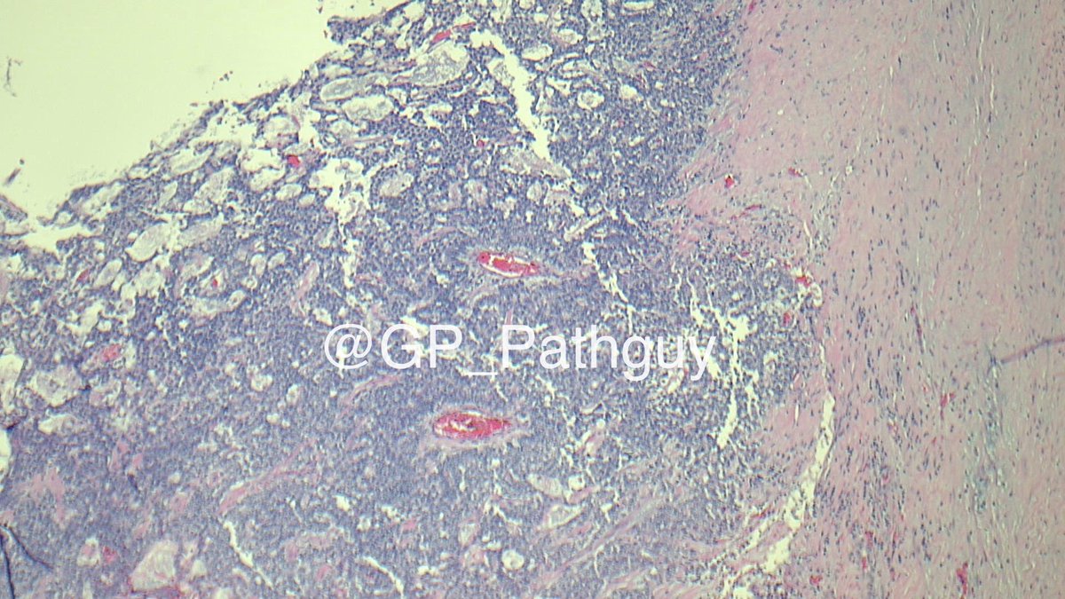 Glenn Murray tweet media