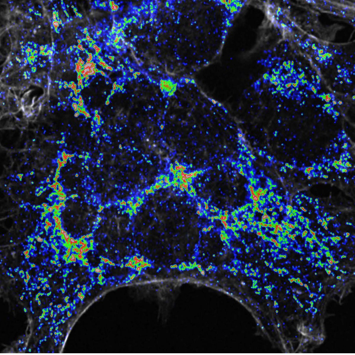 Salk Institute (@salkinstitute) on Twitter photo Salk Prof Reuben Shaw <a href="/LabReuben/">ReubenShawLab</a>, first author Nazma Malik, and team discovered the protein FNIP1 links cellular powerhouse damage to repair during metabolic stress, w/ broad disease implications spanning from #diabetes to #cancer to #neurodegeneration
bit.ly/3H0z8LF Salk Prof Reuben Shaw <a href="/LabReuben/">ReubenShawLab</a>, first author Nazma Malik, and team discovered the protein FNIP1 links cellular powerhouse damage to repair during metabolic stress, w/ broad disease implications spanning from #diabetes to #cancer to #neurodegeneration
bit.ly/3H0z8LF