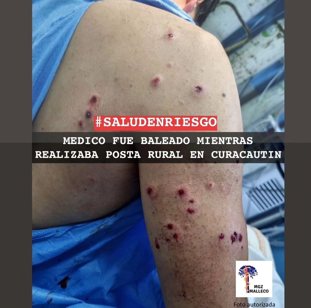 aprachile's tweet photo. Médico baleado en Curacautín, con 25 perdigonazos.

Colegio médico no dice ni pío para no perjudicar al merluzo Boric https://t.co/yFBW68XOWx