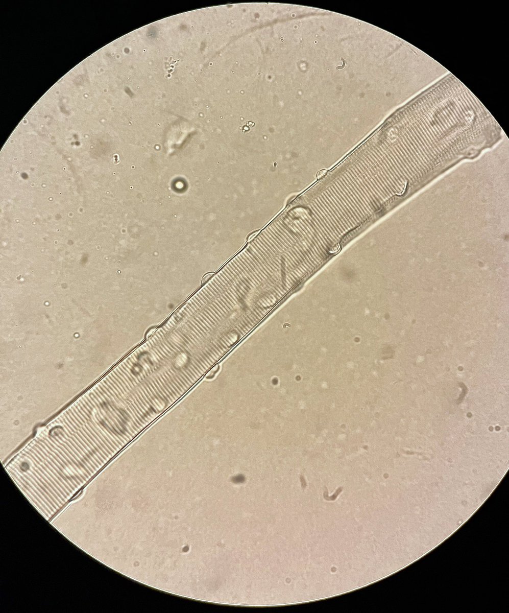 grosalescuba's tweet photo. I have always been fascinated by trying to understand how these wonderful cells function and communicate. Happy Thursday!
#myotwitter #skeletalmuscle #livingcell https://t.co/XapfjW13Mc
