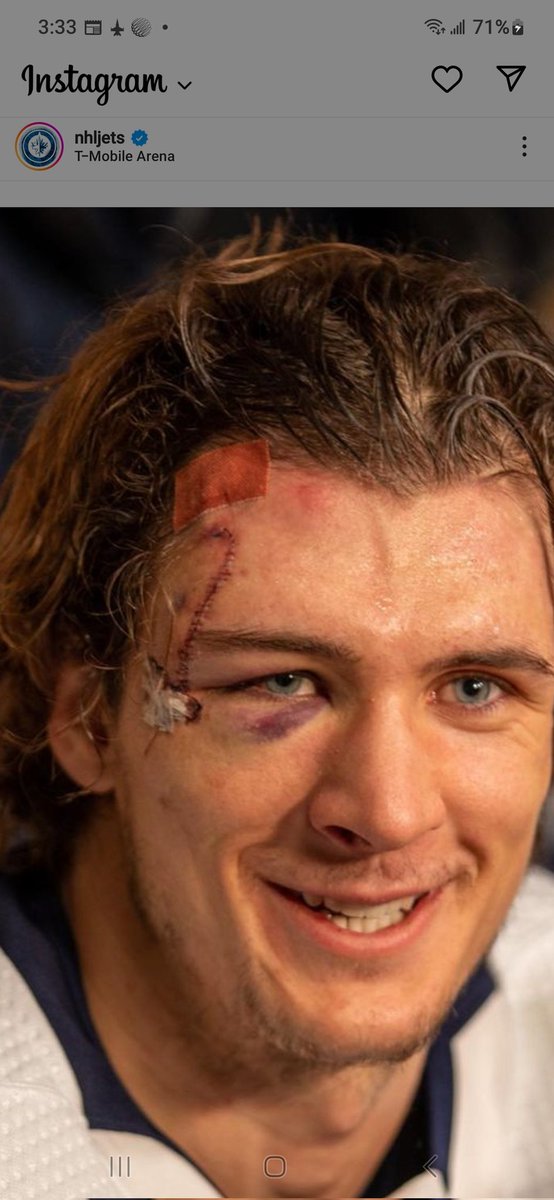 Now that's a story for his grandkids ! #scar to forever be his nickname.
Or #sharkbite re Adam Lowry post-game.

#NHLJets #Winnipeg #whiteout 
#GoJetsGo