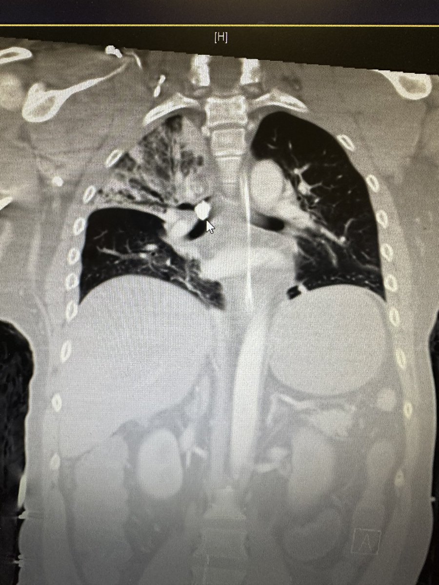 Walter Duarte, MD tweet media