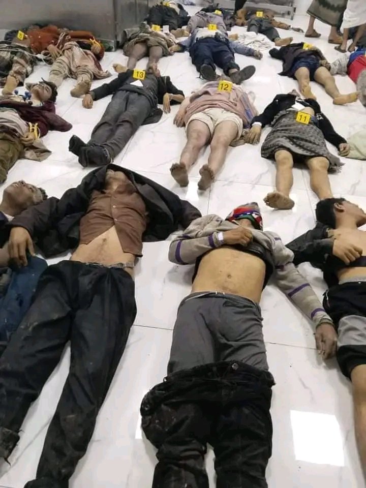 نهنكم جميعابحلول عيدالفطرالمبارك كل عام والجميع بخير!!!الرحمة للشهداء الشفاءللجرحي تعازينالاسرالشهداءالخزي والعار لمن اوصل اليمن لهذاالحال#ادعوبالرحمه لشهداالتجويع الممنهج