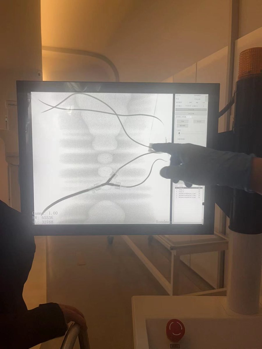 PerloveMedical's tweet photo. In order to improve customer experience and awareness of our interventional #carm, Our sales team has organized a #PLX7100A simulation training for #interventional #surgery. 

More details you want to know>>https://t.co/4RZu6zIRlb https://t.co/9jnxmFWjdU