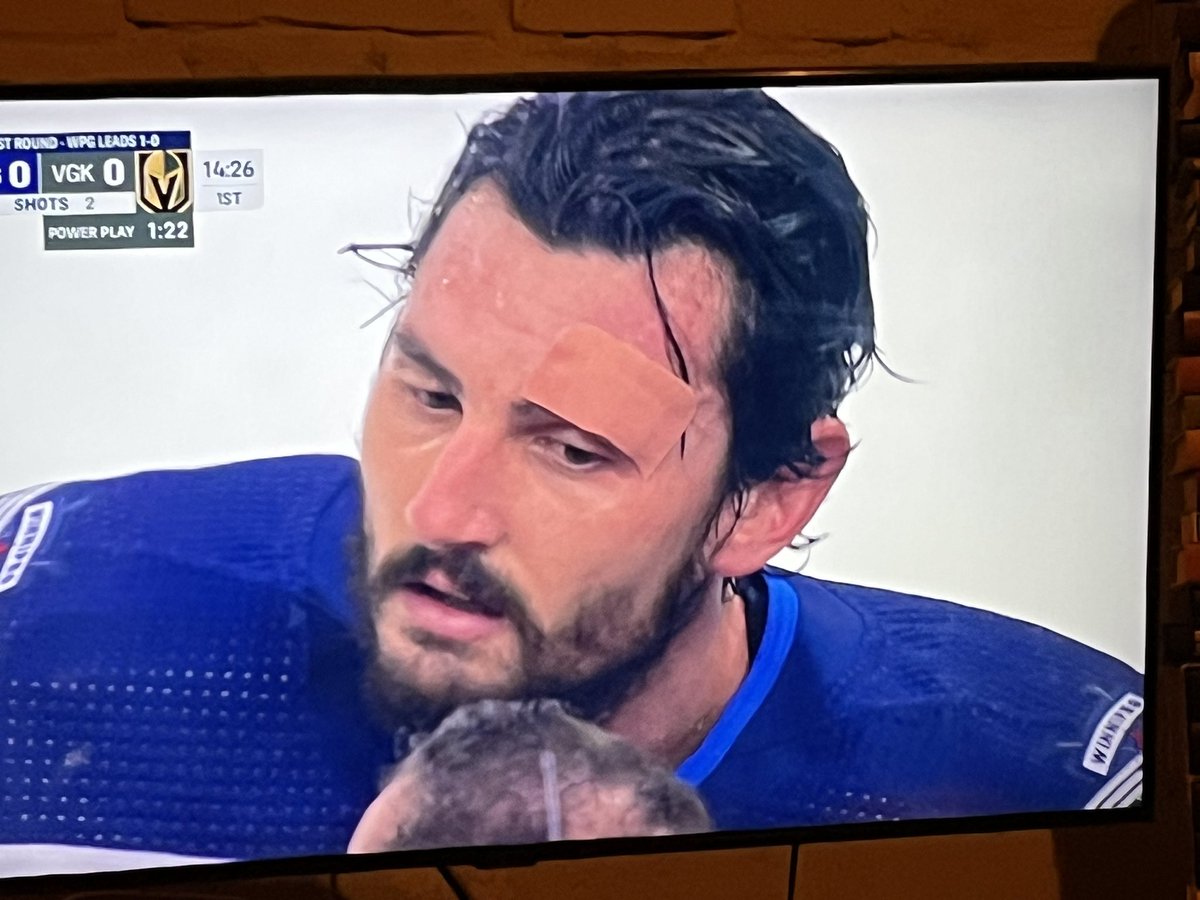 drewkroeker's tweet photo. I’m a dad with no first aid ⛑️ training.  Done a million bandages… BUT How is this an acceptable band aid job? Hair underneath and blocking sight? What? Go jets go! Helle! https://t.co/YdrluZYz7M