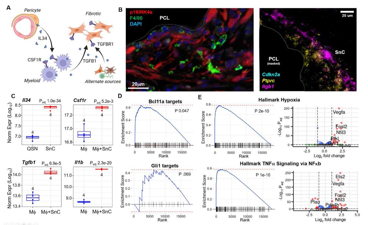 📢New Study in Print
#Transferlearning in a biomaterial #fibrosis model identifies in vivo #senescence heterogeneity and contributions to vascularization and matrix production across species and diverse pathologies.
link.springer.com/article/10.100…
<a href="/HopkinsMedicine/">Johns Hopkins Medicine</a> <a href="/MayoClinic/">Mayo Clinic</a>