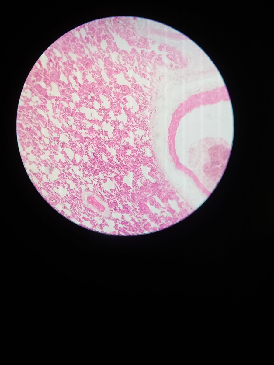 MOTIVATIONBABA0's tweet photo. @BrownJHM @harvardmed #MedTwitter 
A piece of 🫁..... under microscope.... https://t.co/a1h12Hu42D