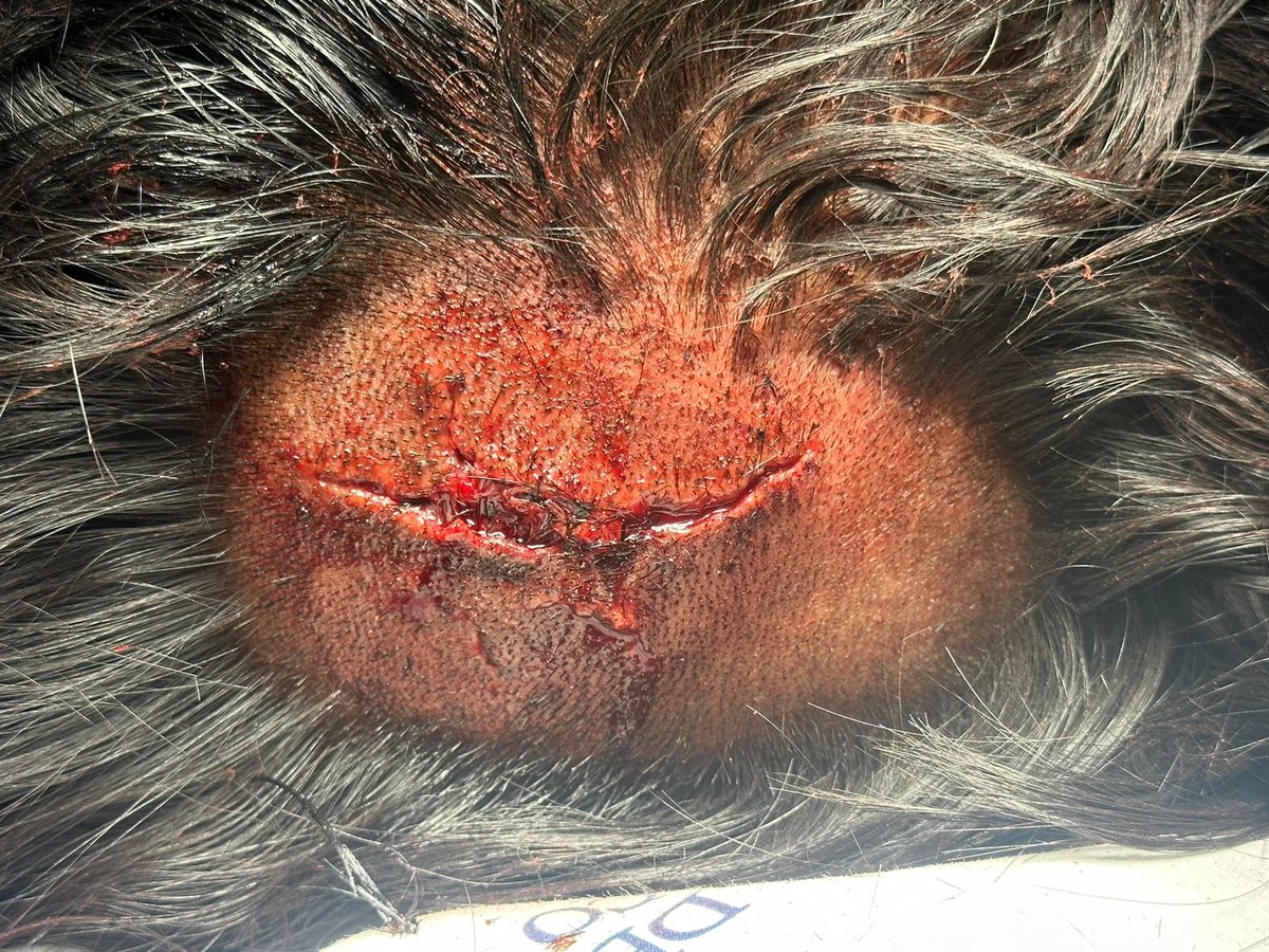 KMaragao's tweet photo. El día de hoy mientras mi primo corría fue atropellado por este poco hombre y ser humano. Nunca se acercó a dar unas disculpas, nunca se acercó a preguntar cómo estaba…NADA. Simplemente se escondió mientras mi primo estaba en el hospital desorientado, con el cráneo fracturado… https://t.co/6Euf2D03Qe