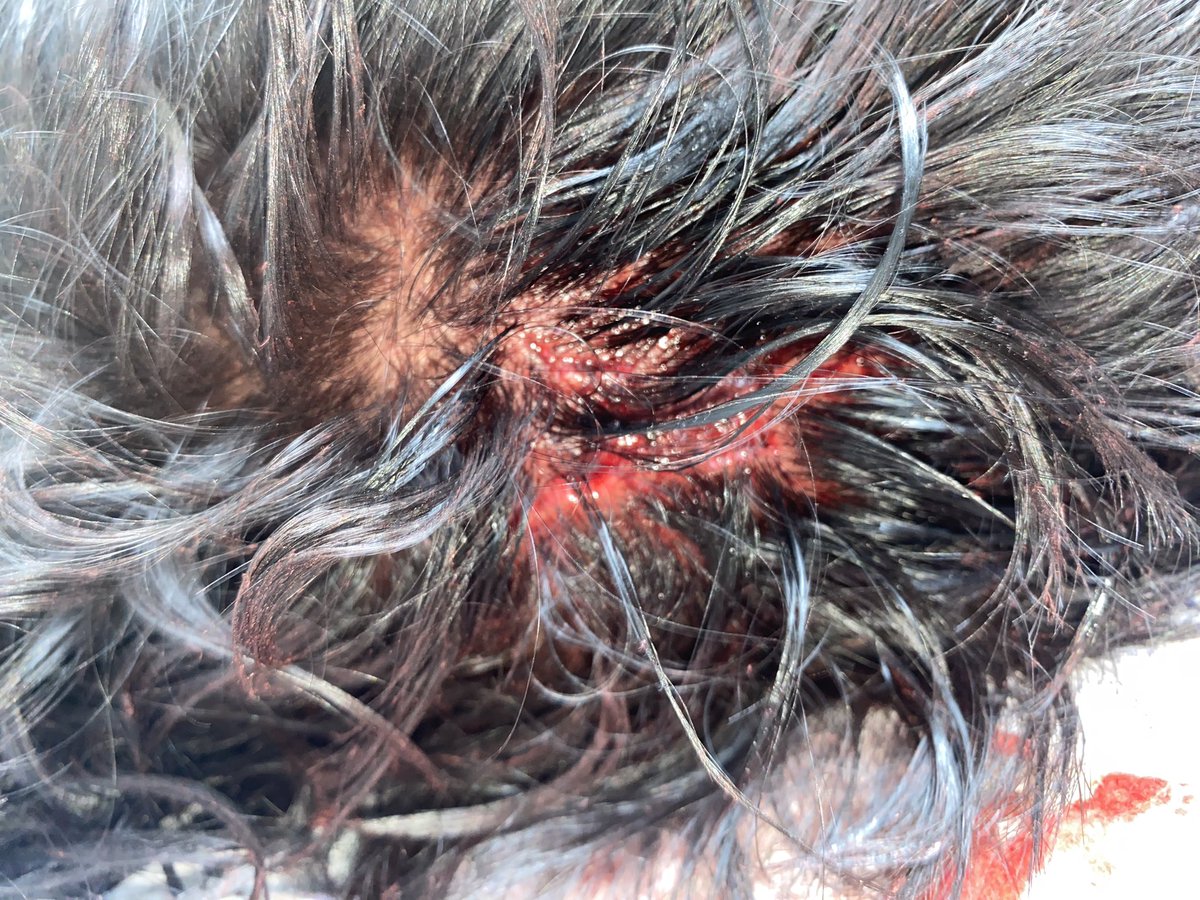 KMaragao's tweet photo. El día de hoy mientras mi primo corría fue atropellado por este poco hombre y ser humano. Nunca se acercó a dar unas disculpas, nunca se acercó a preguntar cómo estaba…NADA. Simplemente se escondió mientras mi primo estaba en el hospital desorientado, con el cráneo fracturado… https://t.co/6Euf2D03Qe