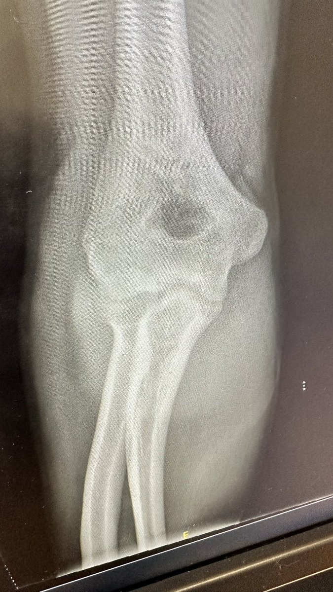 Harvinder tweet media