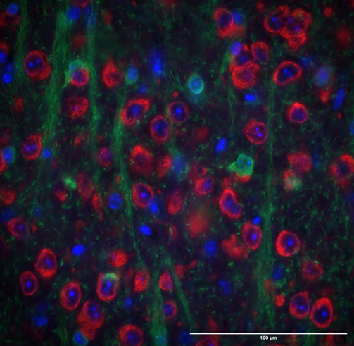 Really proud of the latest work from Faith, @GrantFMarshall and @dannigadd. We used CRISPR to introduce a V5 tag into eEF1A2 to be able to compare expression patterns of eEF1A1 and eEF1A2 in neurons 1/4 biorxiv.org/content/10.110…