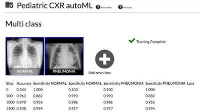 Radiology_AI's tweet photo. Performance and Usability of Code-Free #DeepLearning for Chest Radiograph Classification, Object Detection, and Segmentation https://t.co/KUwNo2N2S8 @PaulYiMD @vishwa_parekh @UM2ii #CodeFree #CFDL #AI https://t.co/SsrMQF2o9j
