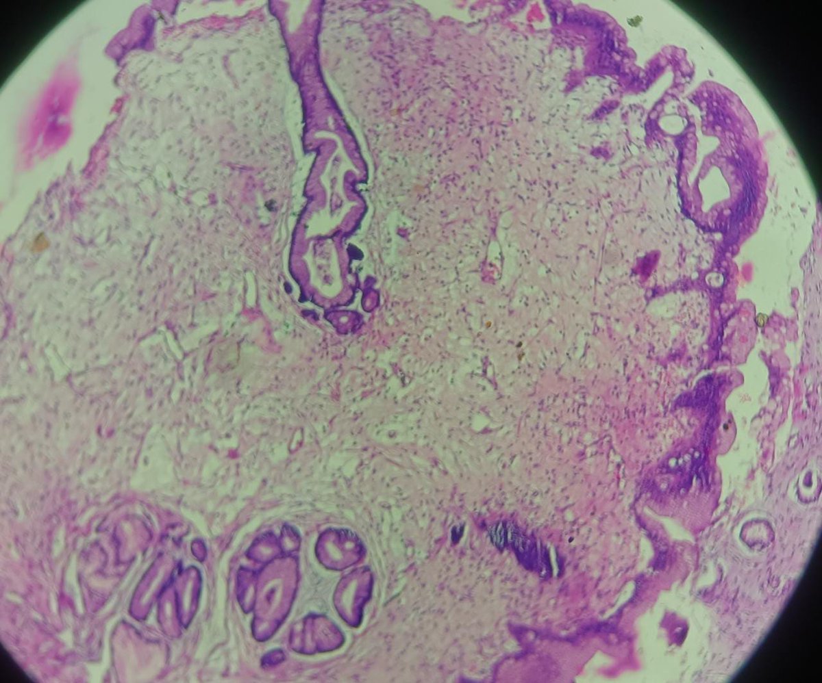 drgopalparikh's tweet photo. 67 female polypoidal gastric and duodenal lesion ?/mlg
#GIpath #RaulGonzalez #RhondaSantis #PathTwitter https://t.co/mhmfNZClO9