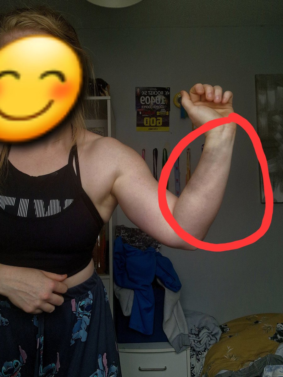char94cooper's tweet photo. Nice little bruise from being stepped on last night 🤣

The joys of being a keeper 🧤⚽️

🔵✖️⚽️ 

#football #goalkeeper #semiretired #love #passion #gym #gymmanger #fitness #workout #bodybuilder https://t.co/kGKXm788nv