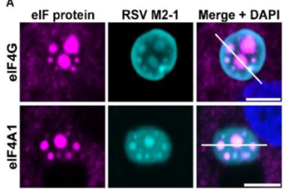 Morbillivirus's tweet photo. These #IBAGs were shown to contain all of the #eIF4F translation initiation machinery, co-localising with RSV M2-1 [eIF4G and eIF4A1 shown here]. So obviously we asked if translation can take place in IBAGs? https://t.co/OHKY14UBxp