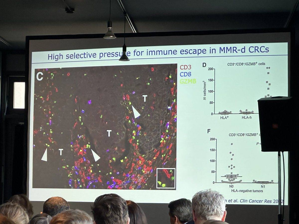 Dr. Noel de Miranda @NFdeMiranda #colon #cancer #CRC #immunology EXPERT @UniLeidenNews talks about his work identifying gamma delta T cells (gdT) that are enriched and present in pts who respond to #CPI/potential to see HLA- tumors/ #TIMO2023 @sitcancer @CCAlliance @FightCRC