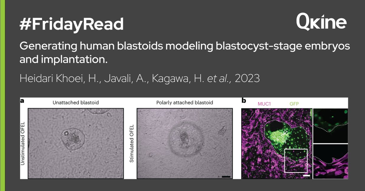 QkineBio's tweet photo. Our latest #FridayRead from Dr. Heidar Heidari Khoei, Dr. Alok Javali, Dr. Harunobu Kagawa and colleagues from @IMBA_Vienna, focuses on the generation of human blastoids and features Qkine hLIF (Qk036). Read the full paper here: https://t.co/tnnrAVdbHc
#HumanBlastoids #hPSCs https://t.co/760zjPmHFZ