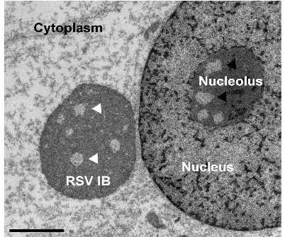 Morbillivirus's tweet photo. Oh 'sugar' I forgot to say we also think it's pretty cool how much they look like #nucleoli ๐ค๐ค. Would like to get some comments on that from experts in the field. https://t.co/Ke8DgtSqoo