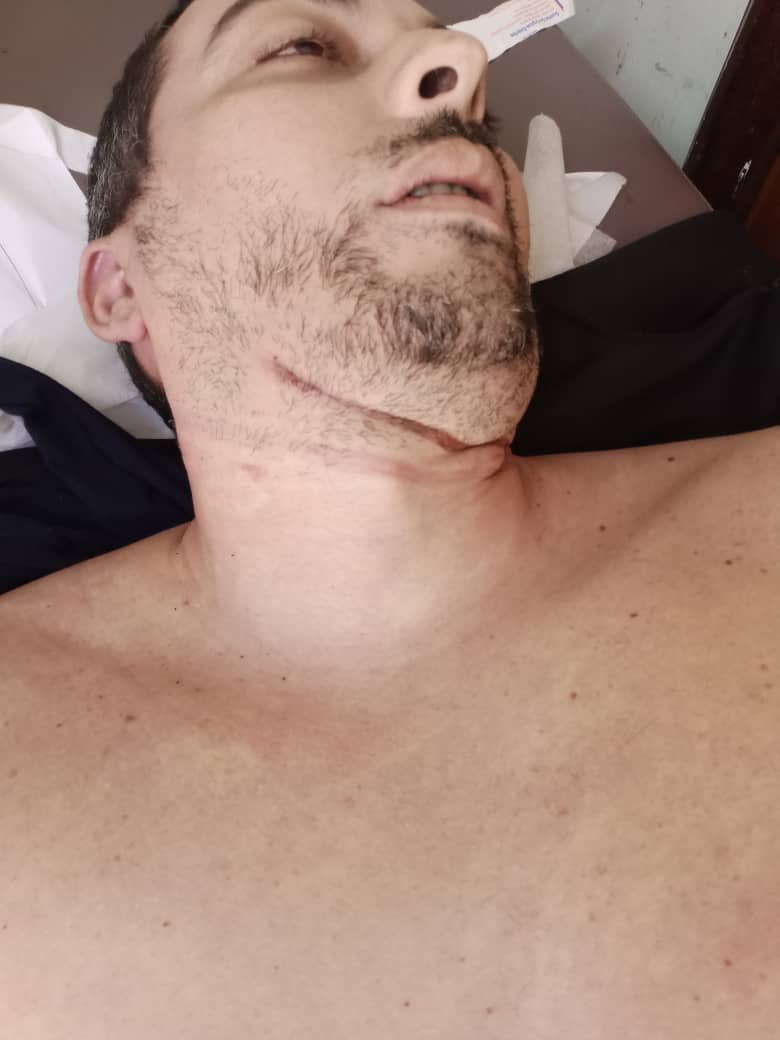 Es la foto de Leoner Azuaje, con esa foto se puede intuir si se ahorcó o lo ahorcaron?