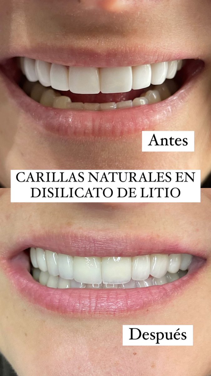 Paomartinezvill's tweet photo. Agradezco todos los días por trabajar haciendo lo que me hace sentir tan feliz y orgullosa de mi. 🤩 https://t.co/Jui3Y9Xep4