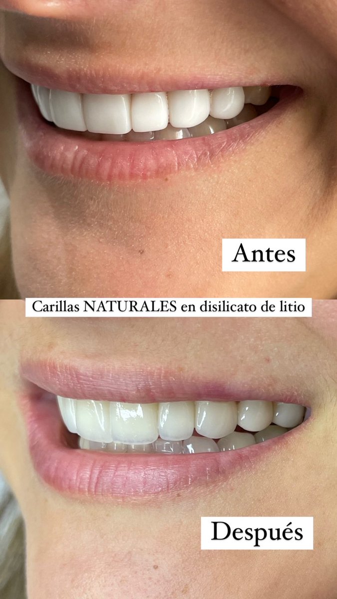 Paomartinezvill's tweet photo. Agradezco todos los días por trabajar haciendo lo que me hace sentir tan feliz y orgullosa de mi. 🤩 https://t.co/Jui3Y9Xep4