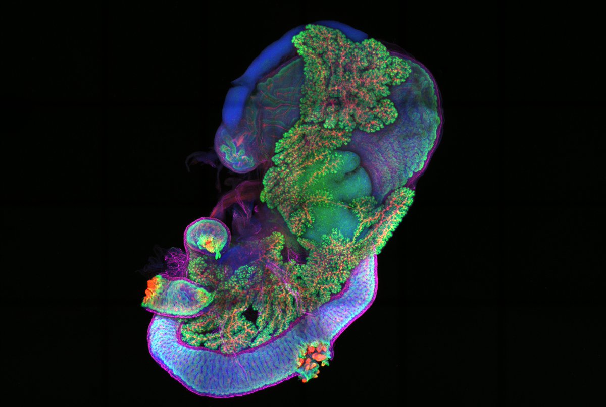 ImarisSoftware's tweet photo. 𝐈𝐍𝐒𝐈𝐆𝐇𝐓 𝐀𝐖𝐀𝐑𝐃𝐒 𝟐𝟎𝟐𝟑

Wholemount immunofluorescence staining of a whole E16 mouse pancreas, with the spleen, stomach and duodenum intact. The tissue was imaged using a confocal microscope &amp; processed in Imaris. Credit: @CedricYuPhD (@UCSF)

https://t.co/CabmM44dyd https://t.co/CdQiS9UYQH