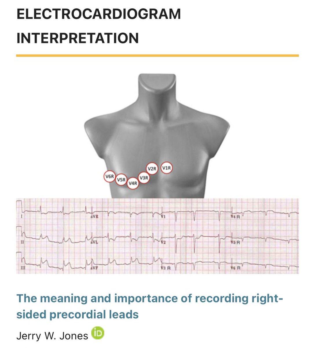 fem.tums.ac.ir/index.php/fem/…

#FrontEmergMed #emergency_medicine #emergency_department #emergency_physicians #EmergMed #MedEd #EmergencyMedicine #EvidenceBasedMedicine #MedicalEducation #MedicalResearch #MedicalScience #EmergencyMedicineJournals #MedicalJournal