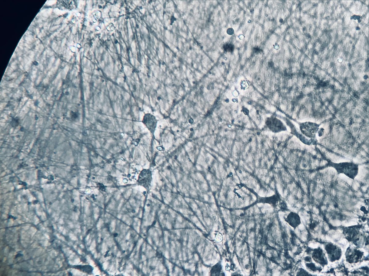 Cleide Souza (@cleideneuro) on Twitter photo For those who need to see Motor Neuron today. Happy Friday. #neuroscience #stemcells <a href="/neuroshef/">Neuroscience Institute</a> For those who need to see Motor Neuron today. Happy Friday. #neuroscience #stemcells <a href="/neuroshef/">Neuroscience Institute</a>