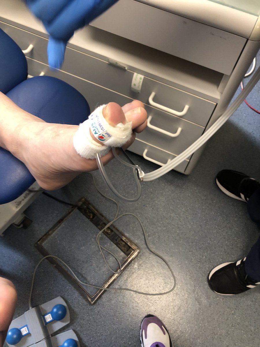mornapod's tweet photo. Practising toe pressures in Hackney #vascularhealth #savinglimbs #systoe @RoyColPod @foothealthhuh @NHSHomerton https://t.co/Q3JjCgOqUc