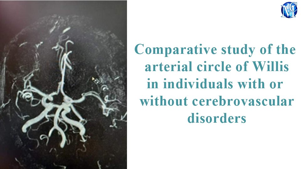 medcraveonline's tweet photo. Comparative study of the arterial #circleof Willis in #individualswith or without #cerebrovascular #disorders, published in MOJ #Anatomy& #Physiologyby Valchkevich Dzmitry, et al.
Know more on this topic:
https://t.co/BuzhKli2tb
#brain #artery #neurology #surgery #stroke https://t.co/tQim771rKy