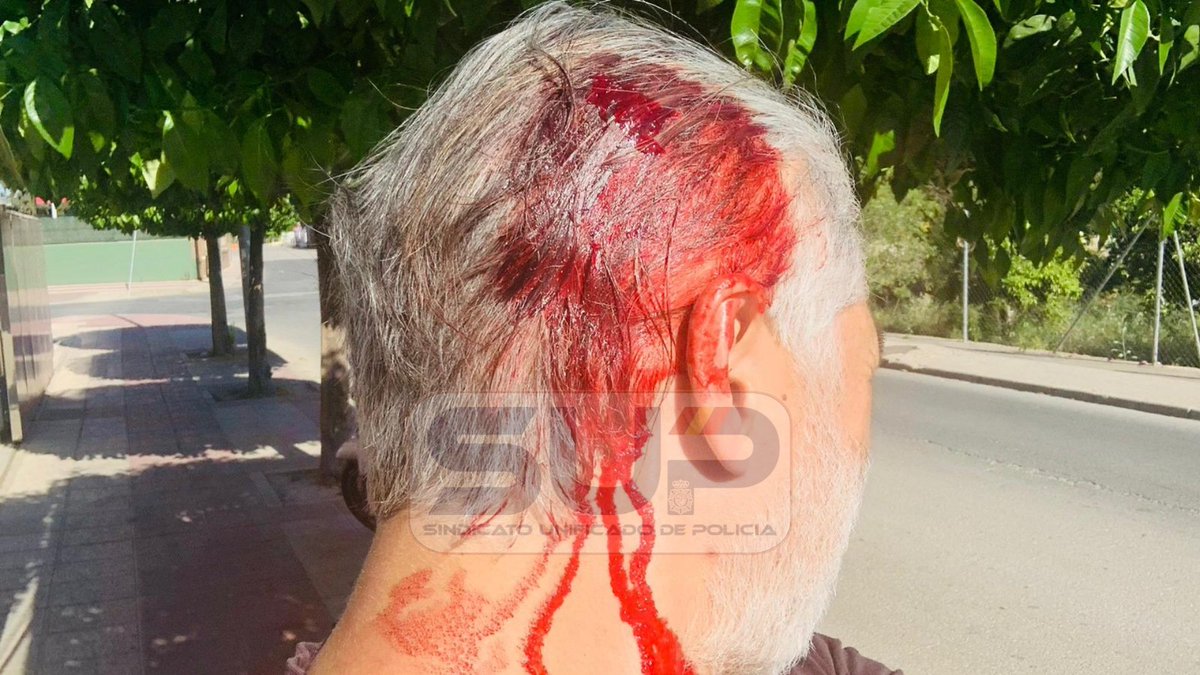 Sup_Policia's tweet photo. Deseamos #ProntaRecuperación a nuestro #compañero agredido brutalmente en Alcantarilla, #Murcia 
#FueraDeServicio asistía a una mujer que sufrió un robo en su vehículo
Fue agredido por 3 hombres en las inmediaciones
Tiene todo el apoyo de nuestro #GabineteJurídico de @SUP_Murcia https://t.co/UD0Y5yy8uA